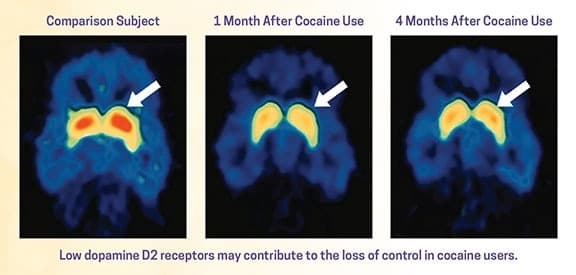 Drugs, Brains, and Behavior: The Science of Addiction